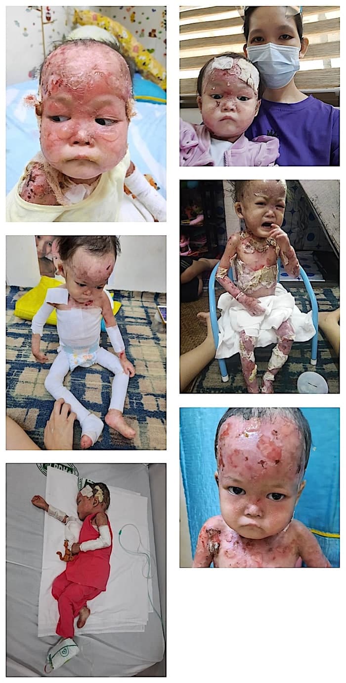 Help for Lily
