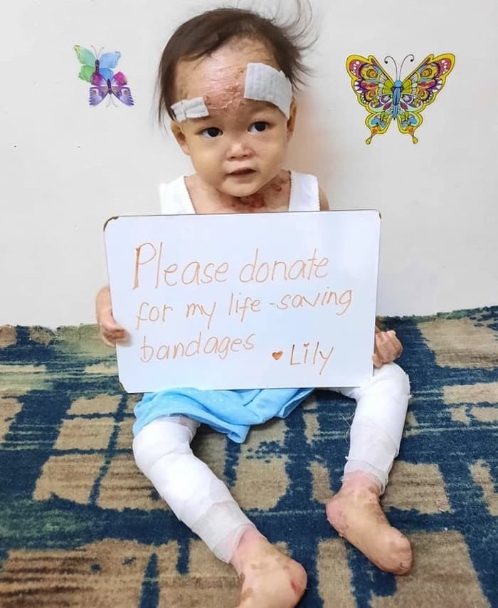 Help for Lily