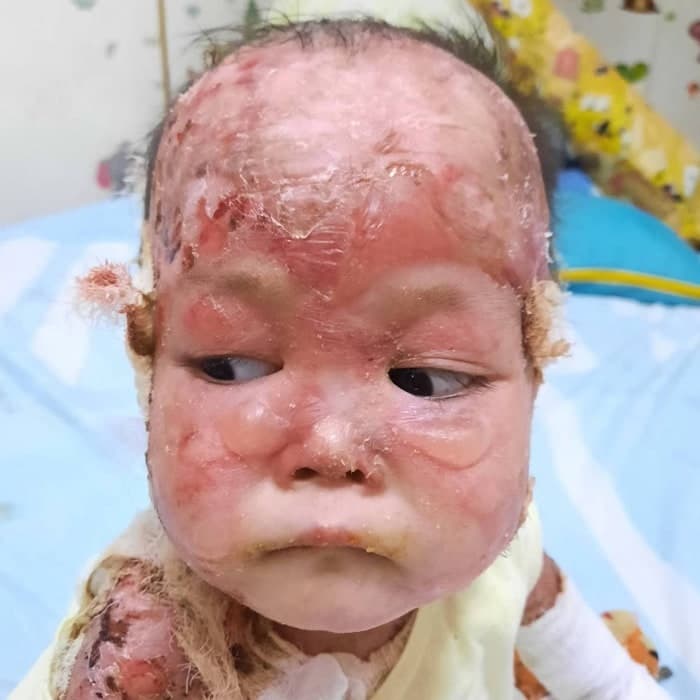 Lily vive con un dolor que ningún niño debería soportar