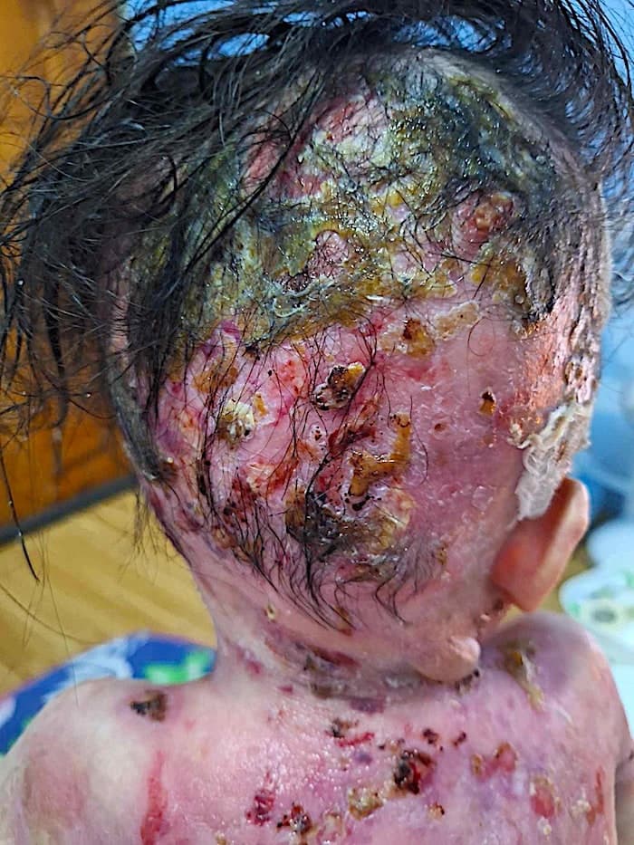 Lily vive con un dolor que ningún niño debería soportar
