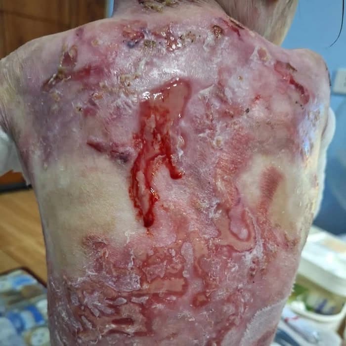 Lily vive con un dolor que ningún niño debería soportar