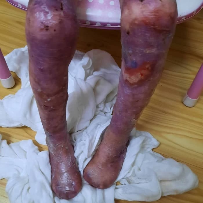 Lily vive con un dolor que ningún niño debería soportar