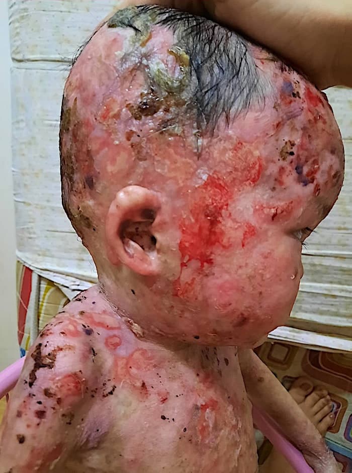 Lily vive con un dolor que ningún niño debería soportar