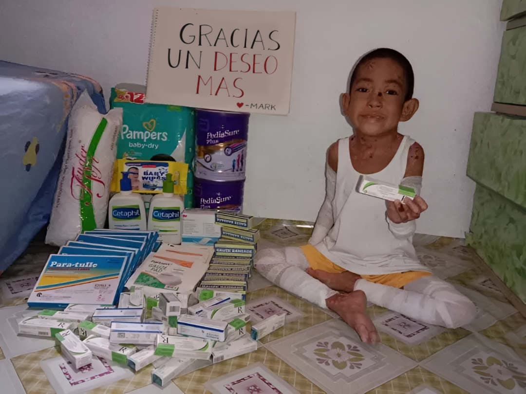Ayuda para Mark