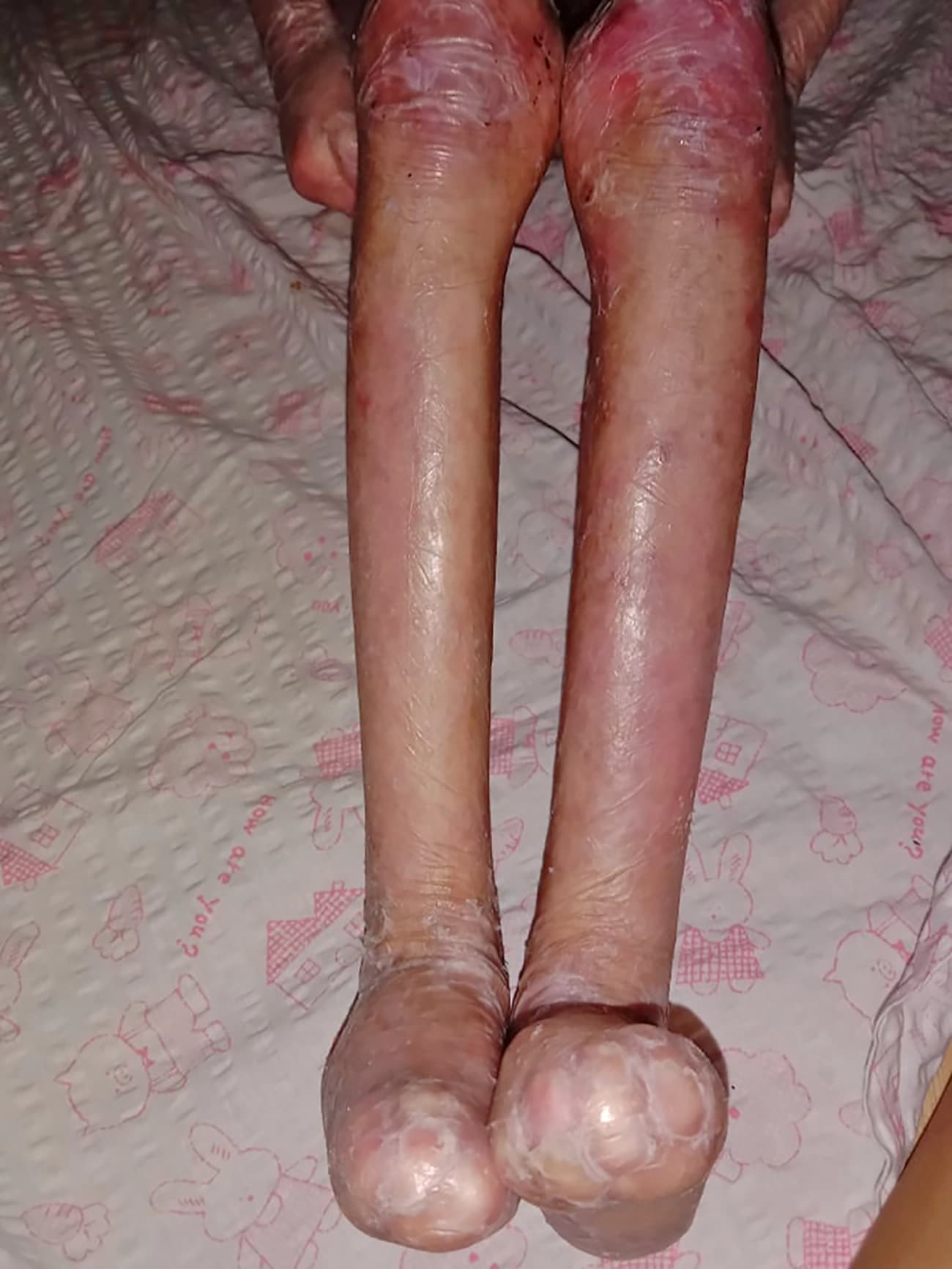 Help for Shamila