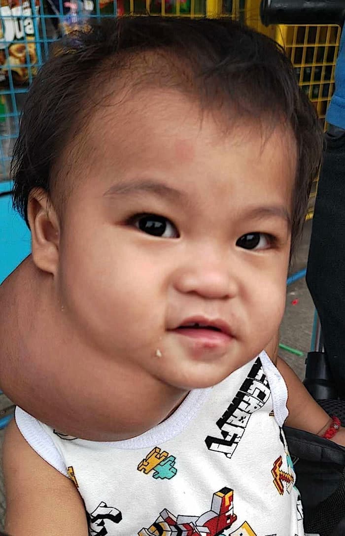 Akiro vive con un dolor que ningún niño debería soportar