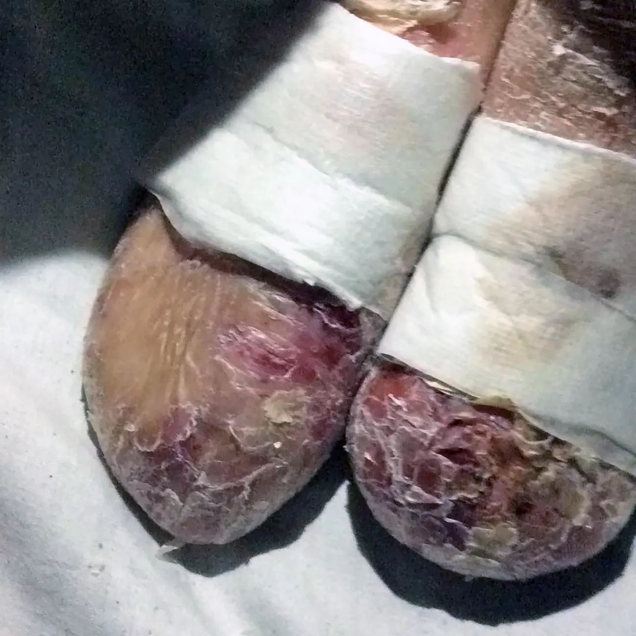 Ashley vive con un dolor que ningún niño debería soportar