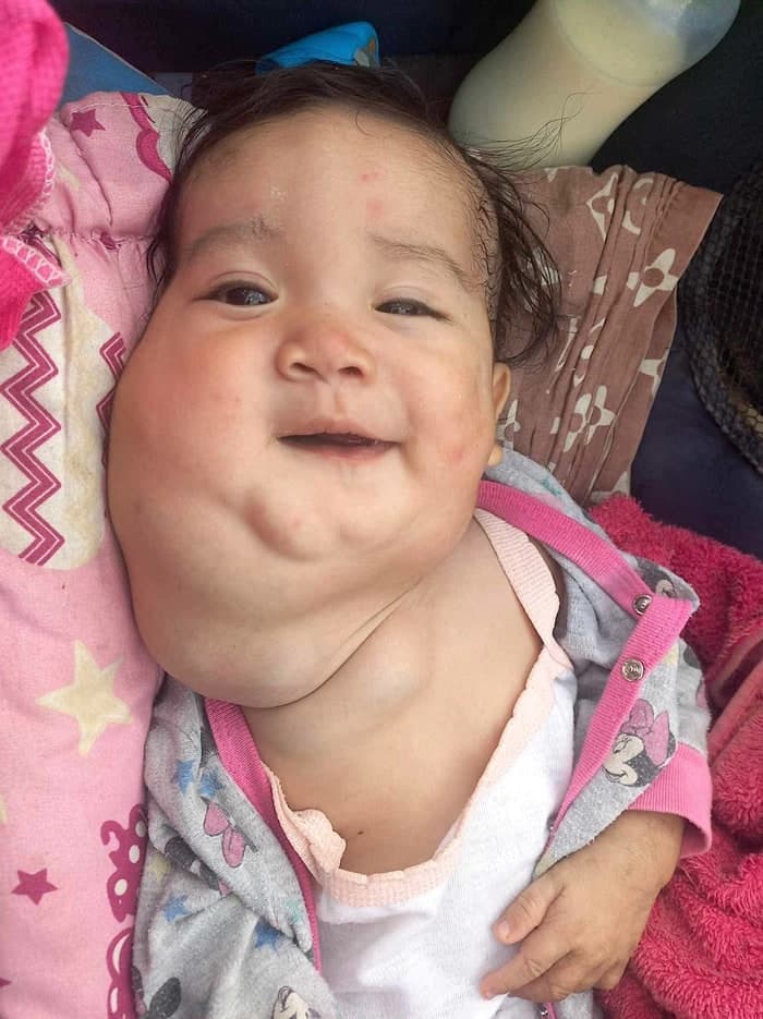 Help for Isabella