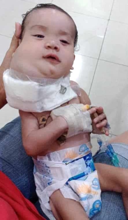 Help for Isabella