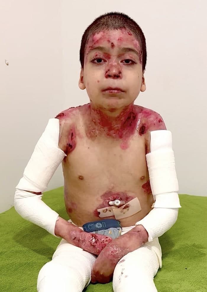 Jesús vive con un dolor que ningún niño debería soportar