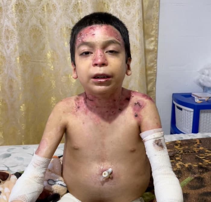 Jesús vive con un dolor que ningún niño debería soportar