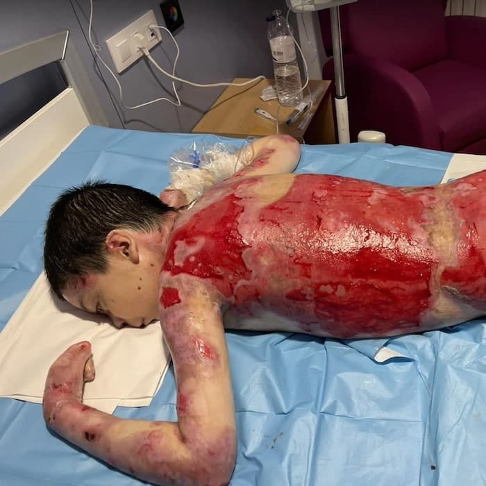 Jesús vive con un dolor que ningún niño debería soportar