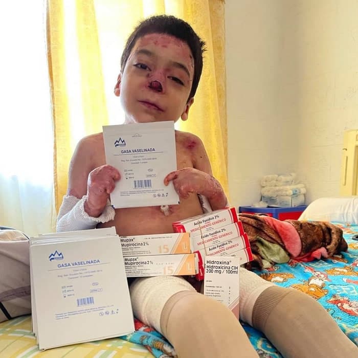 Jesús vive con un dolor que ningún niño debería soportar