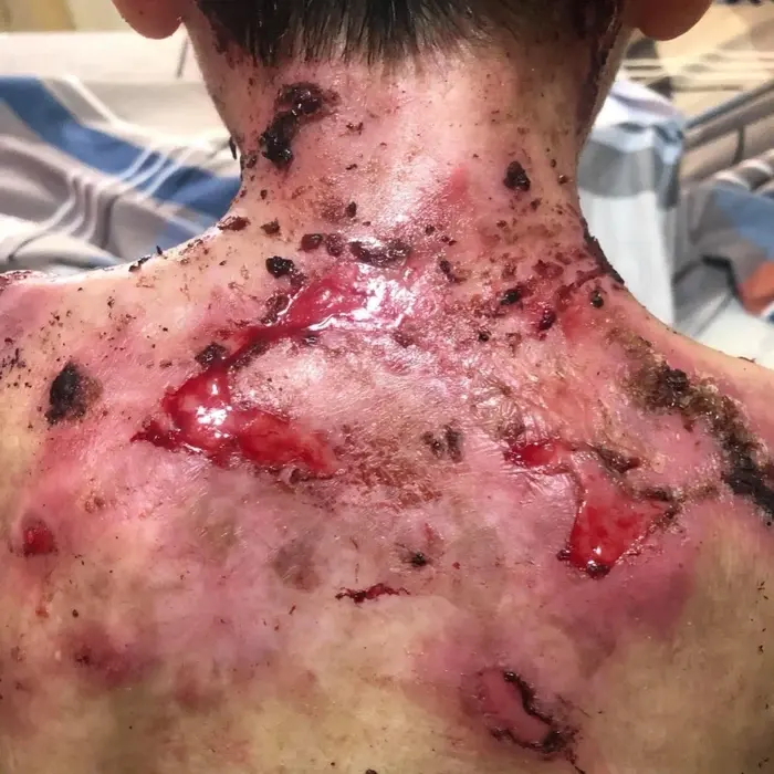 Jesús vive con un dolor que ningún niño debería soportar