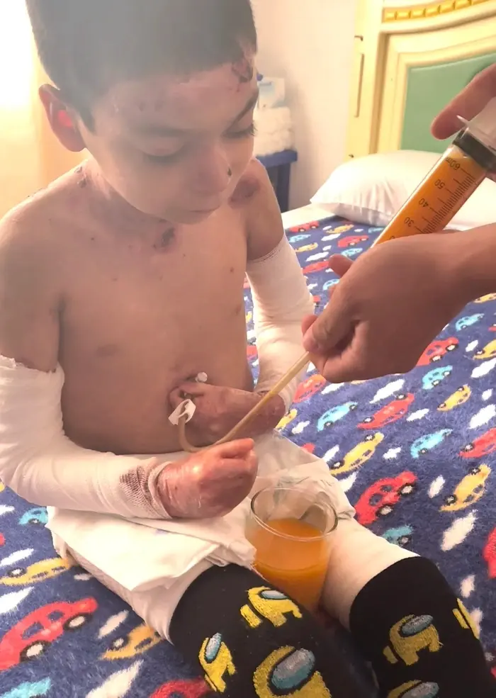 Jesús vive con un dolor que ningún niño debería soportar