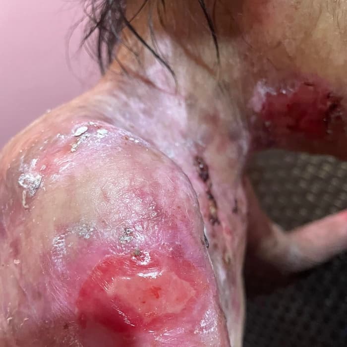 Help for Joyce