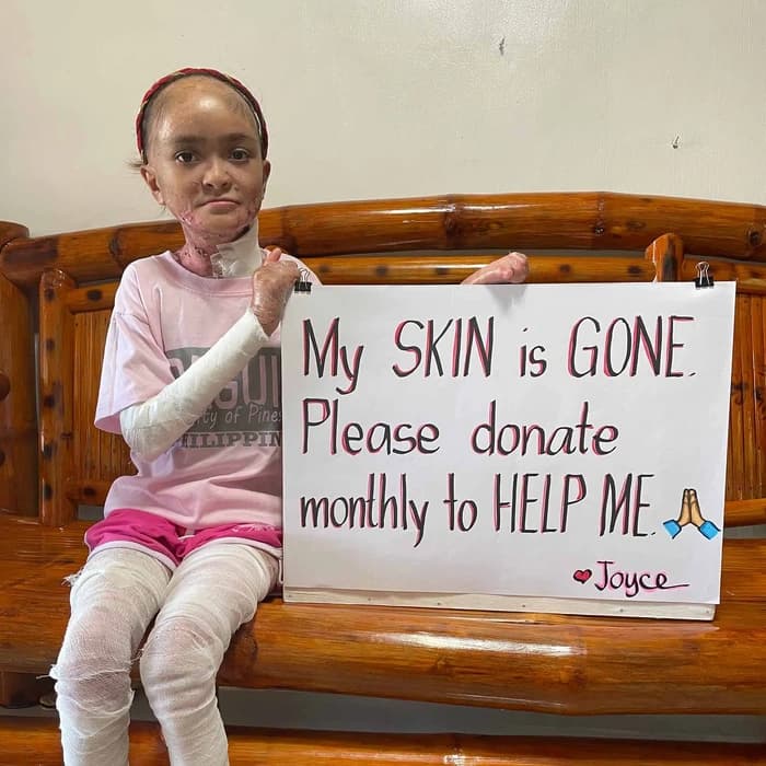 Help for Joyce