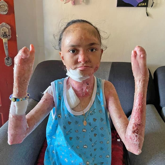 Help for Joyce