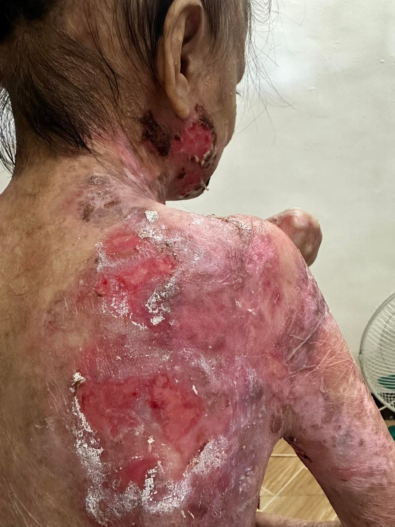 Help for Joyce