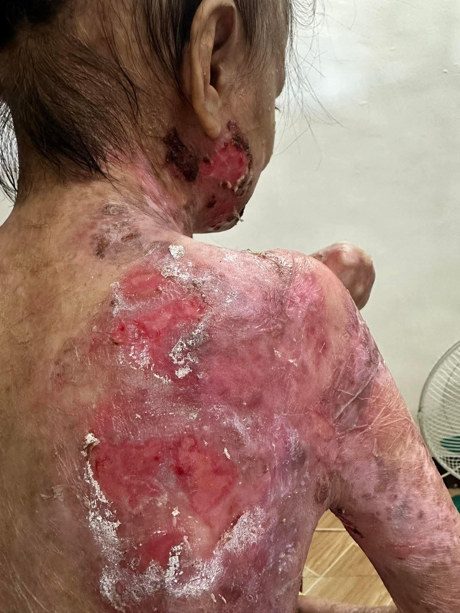 Joyce vive con un dolor que ningún niño debería soportar