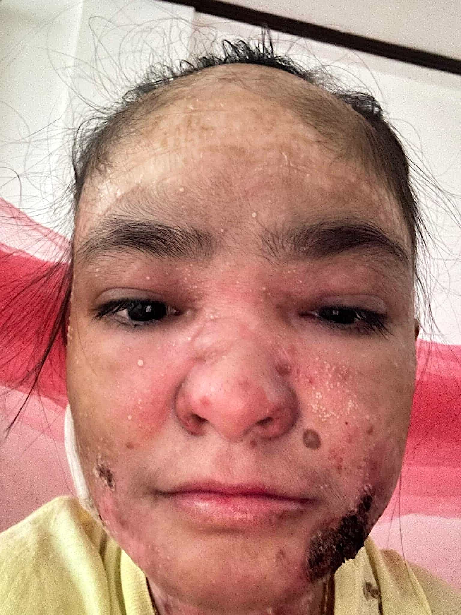 Help for Joyce