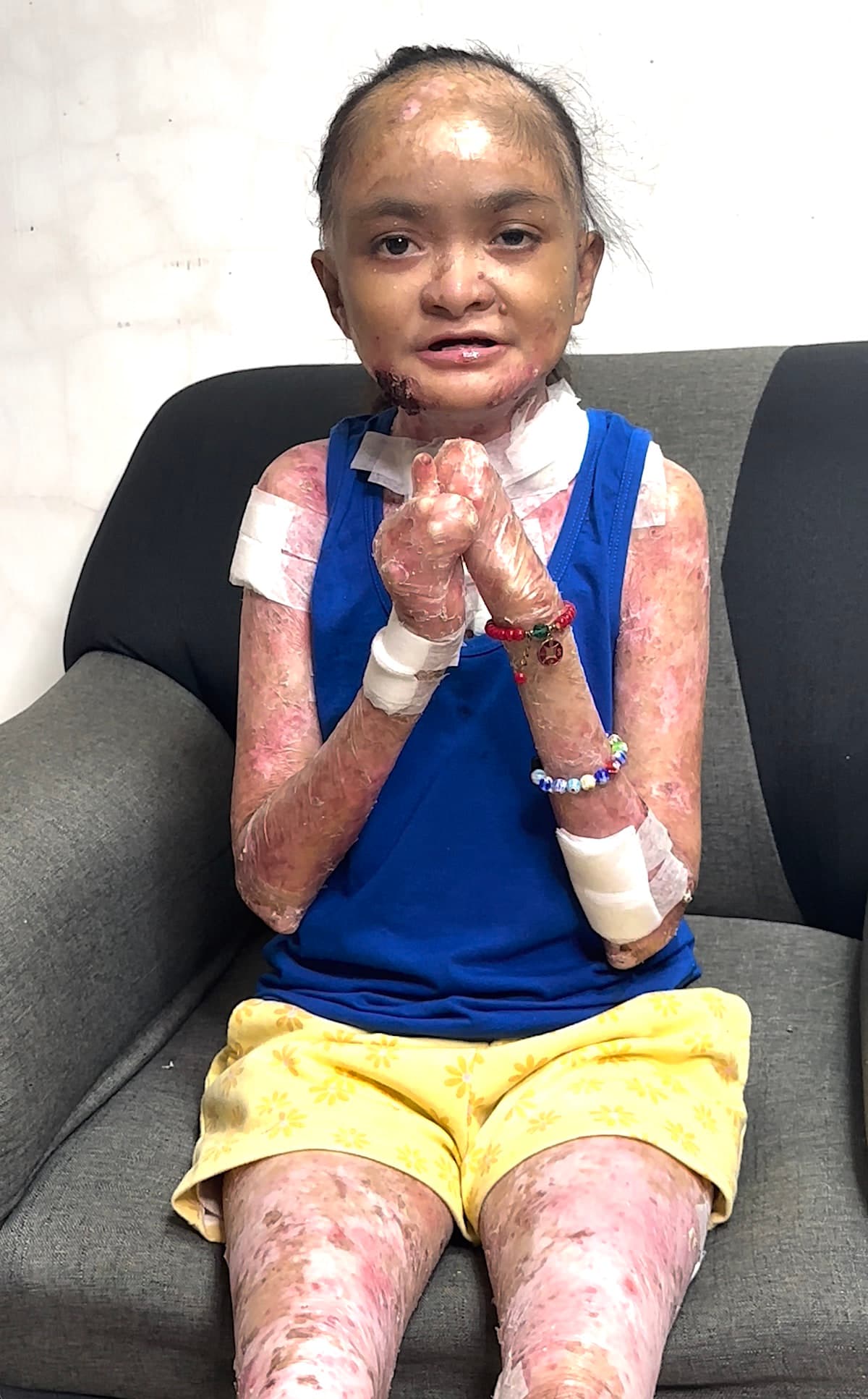 Help for Joyce