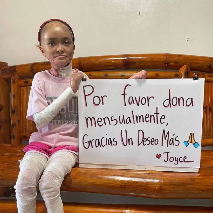 Joyce vive con un dolor que ningún niño debería soportar
