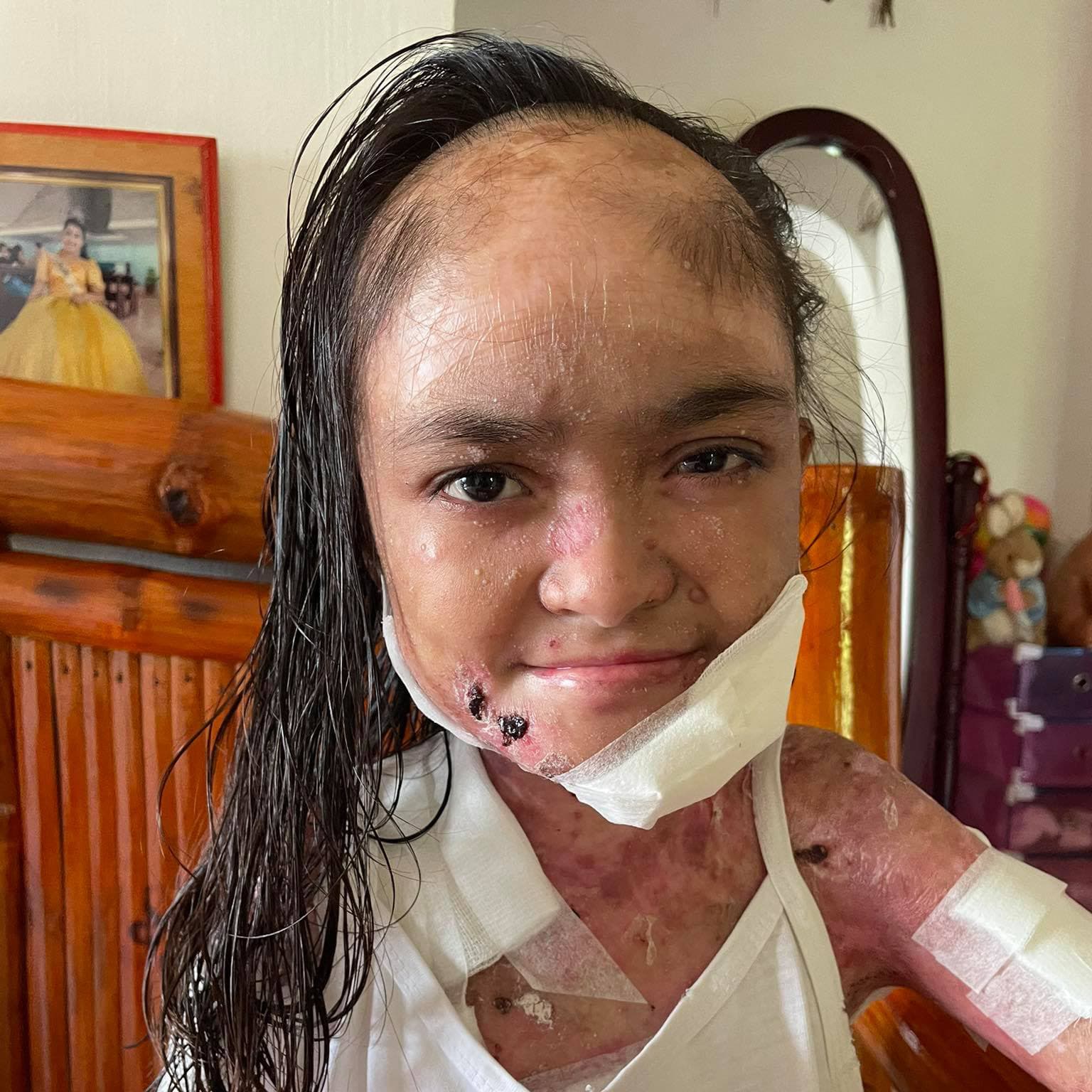 Help for Joyce
