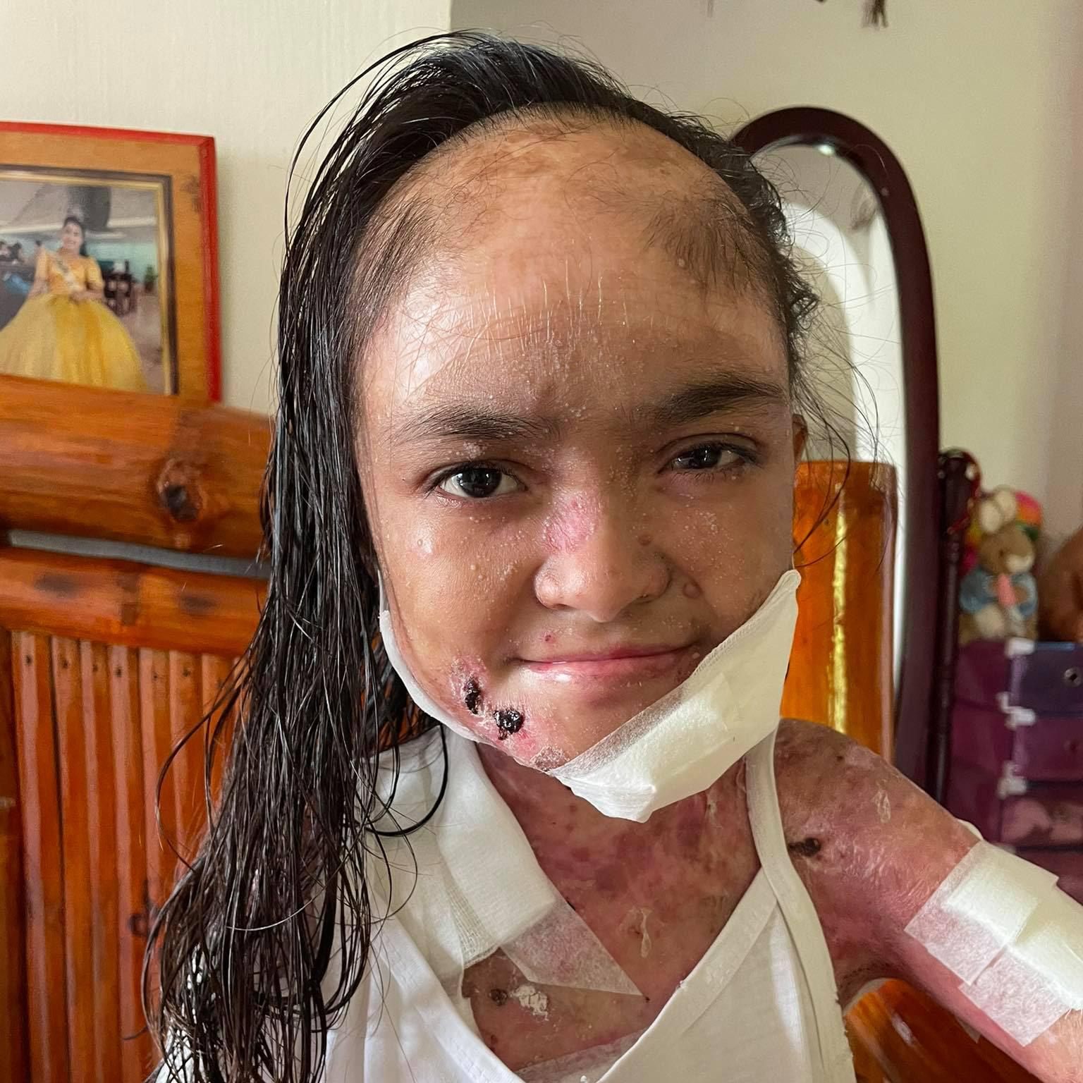 Joyce vive con un dolor que ningún niño debería soportar