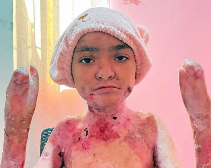Help for Joyce