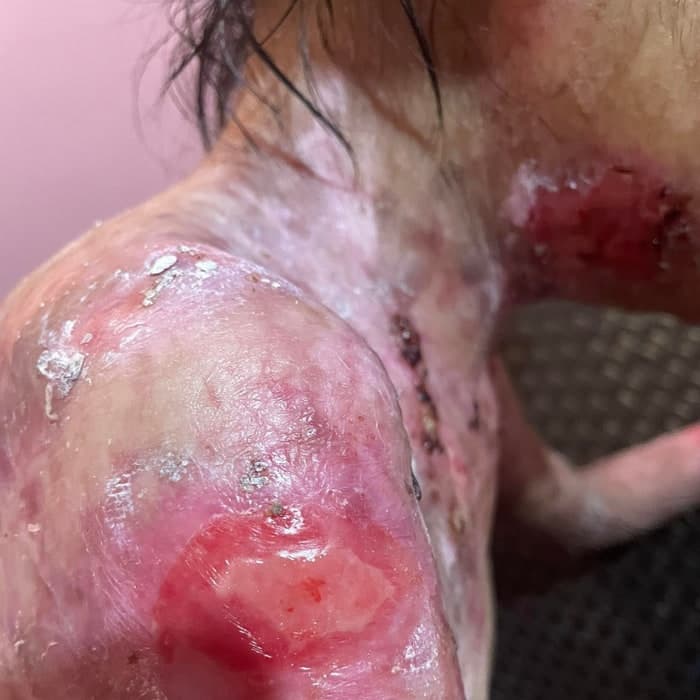 Help for Joyce