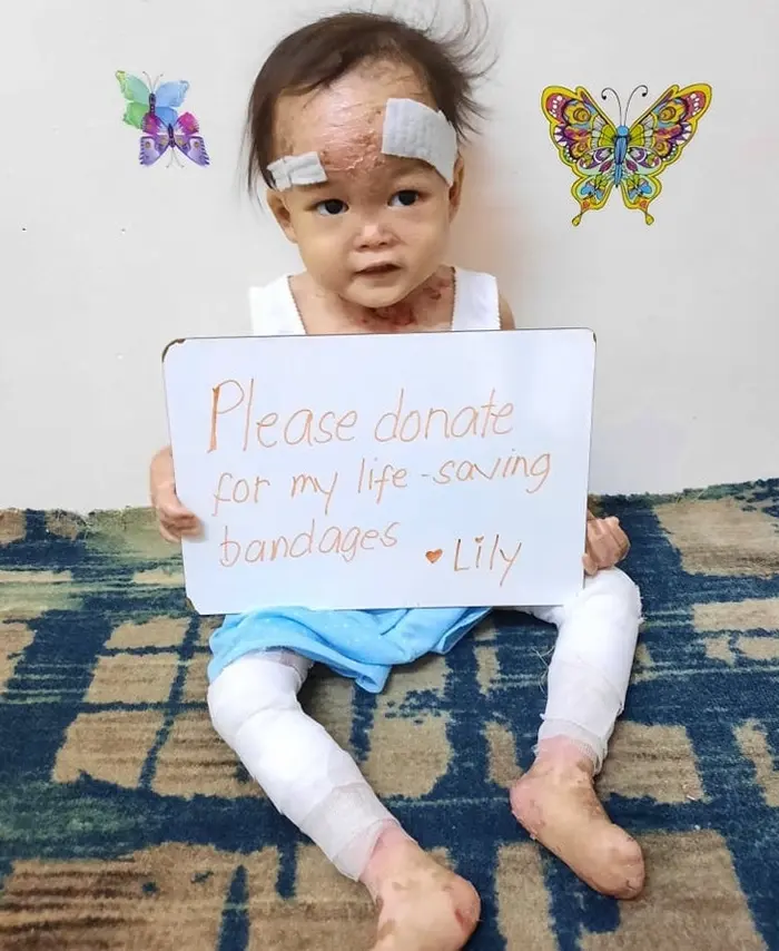 Lily vive con un dolor que ningún niño debería soportar