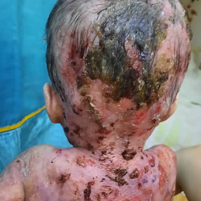 Help for Lily