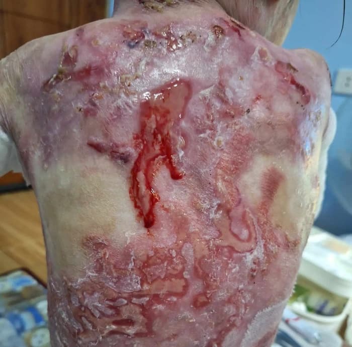 Help for Lily