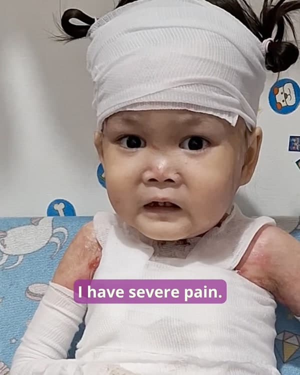 Help for Lily