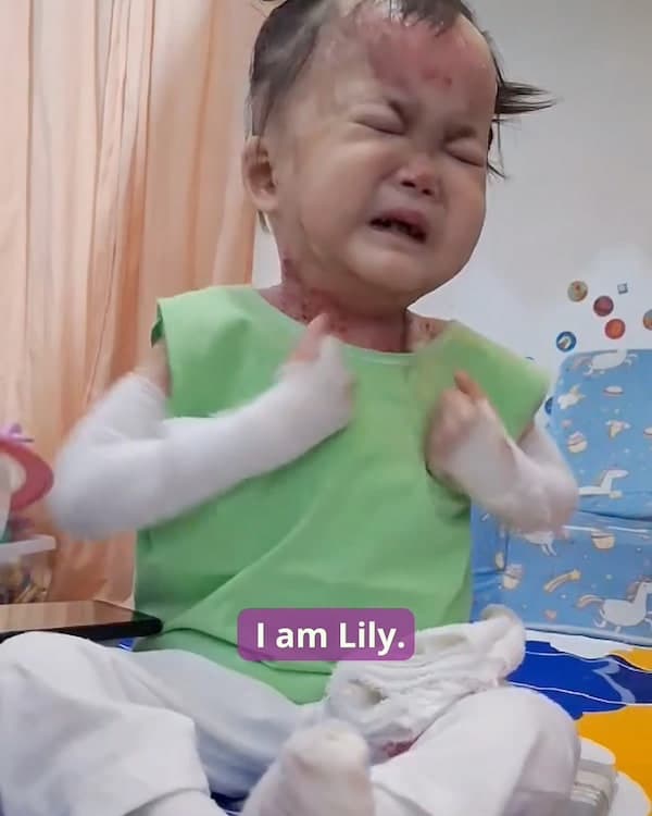 Help for Lily