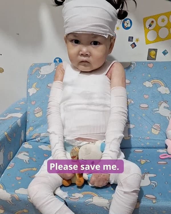 Help for Lily