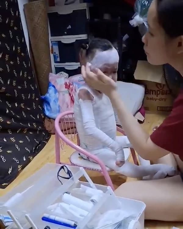 Help for Lily