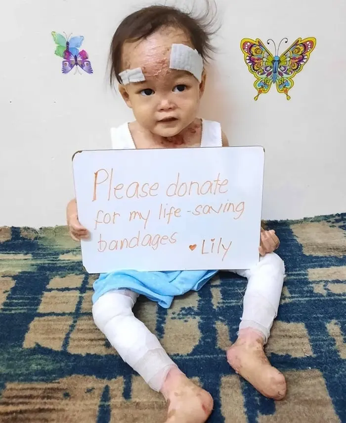 Lily vive con un dolor que ningún niño debería soportar