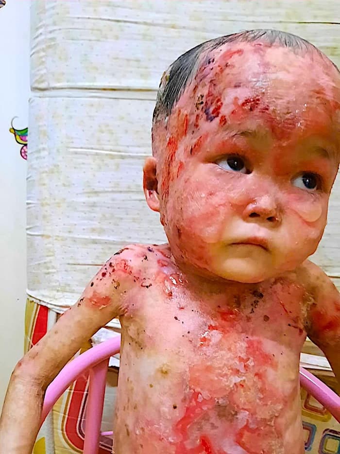 Lily vive con un dolor que ningún niño debería soportar