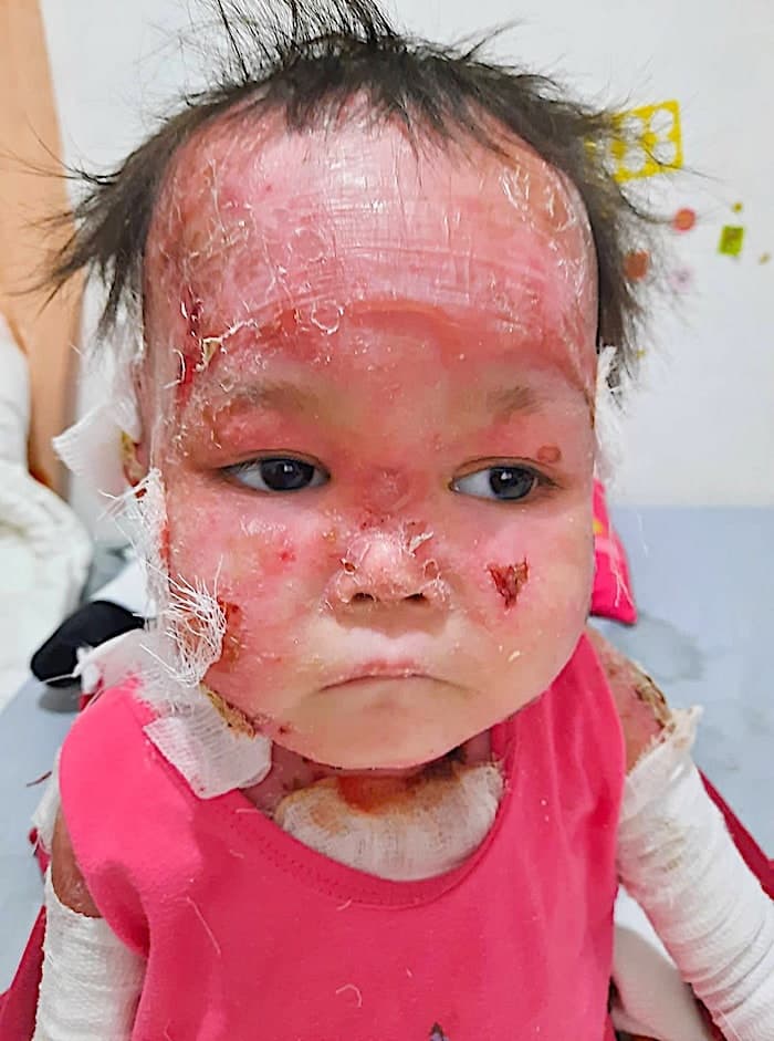 Lily vive con un dolor que ningún niño debería soportar