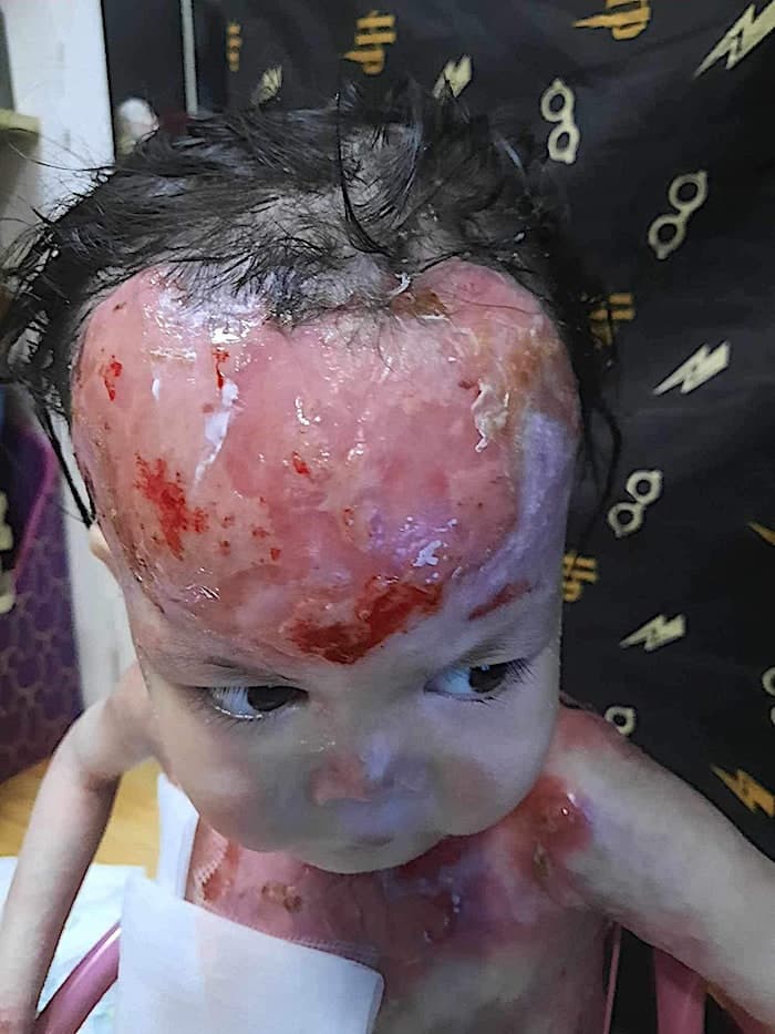 Lily vive con un dolor que ningún niño debería soportar