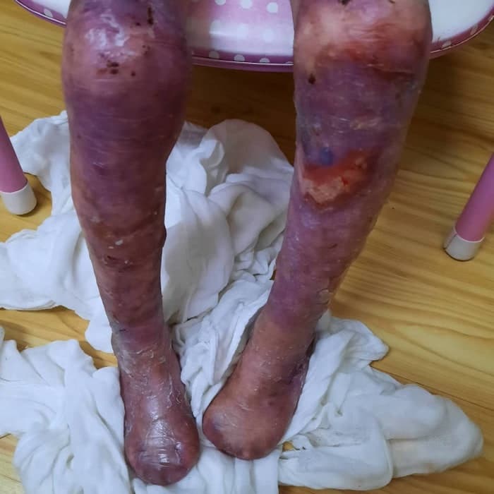 Lily vive con un dolor que ningún niño debería soportar