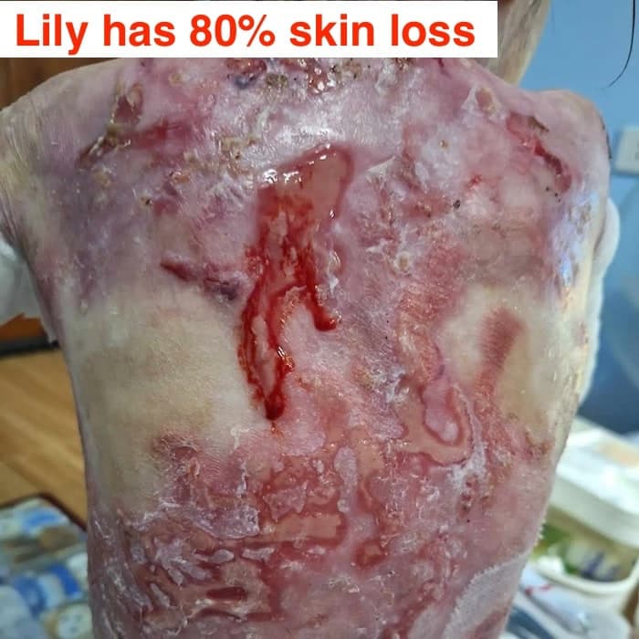Help for Lily