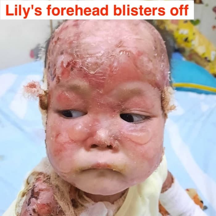Help for Lily