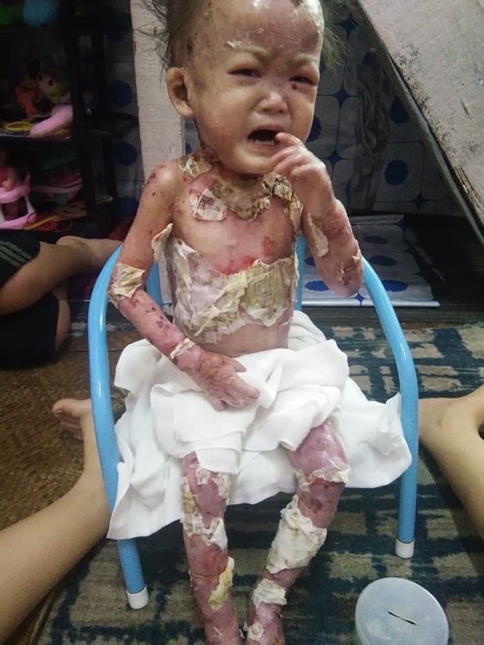 Help for Lily