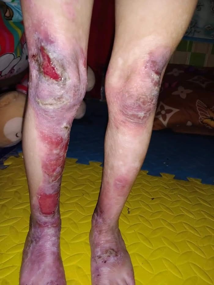 Help for Nathania