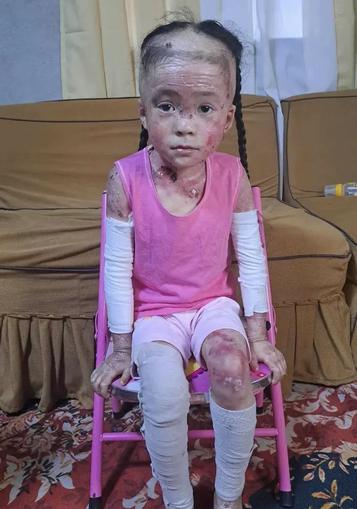 Nathania vive con un dolor que ningún niño debería soportar