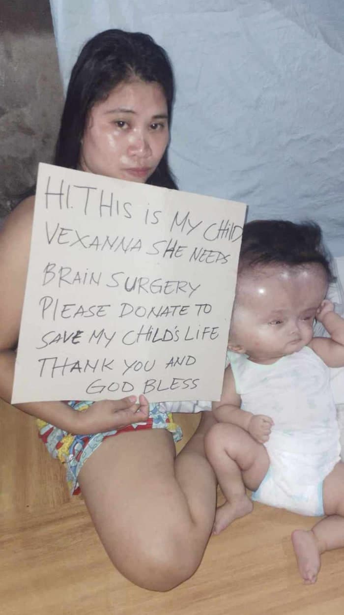 Vexanna vive con un dolor que ningún niño debería soportar