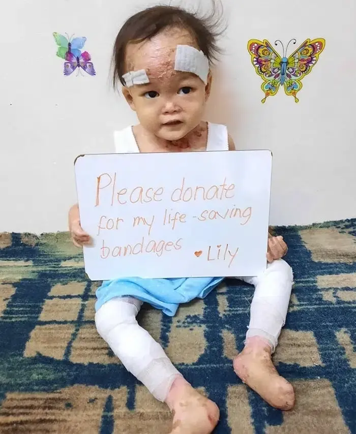 Lily vive con un dolor que ningún niño debería soportar